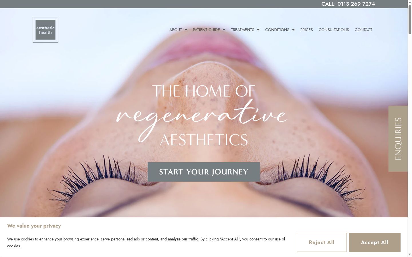 Screenshot of the consent banner shown before any interaction