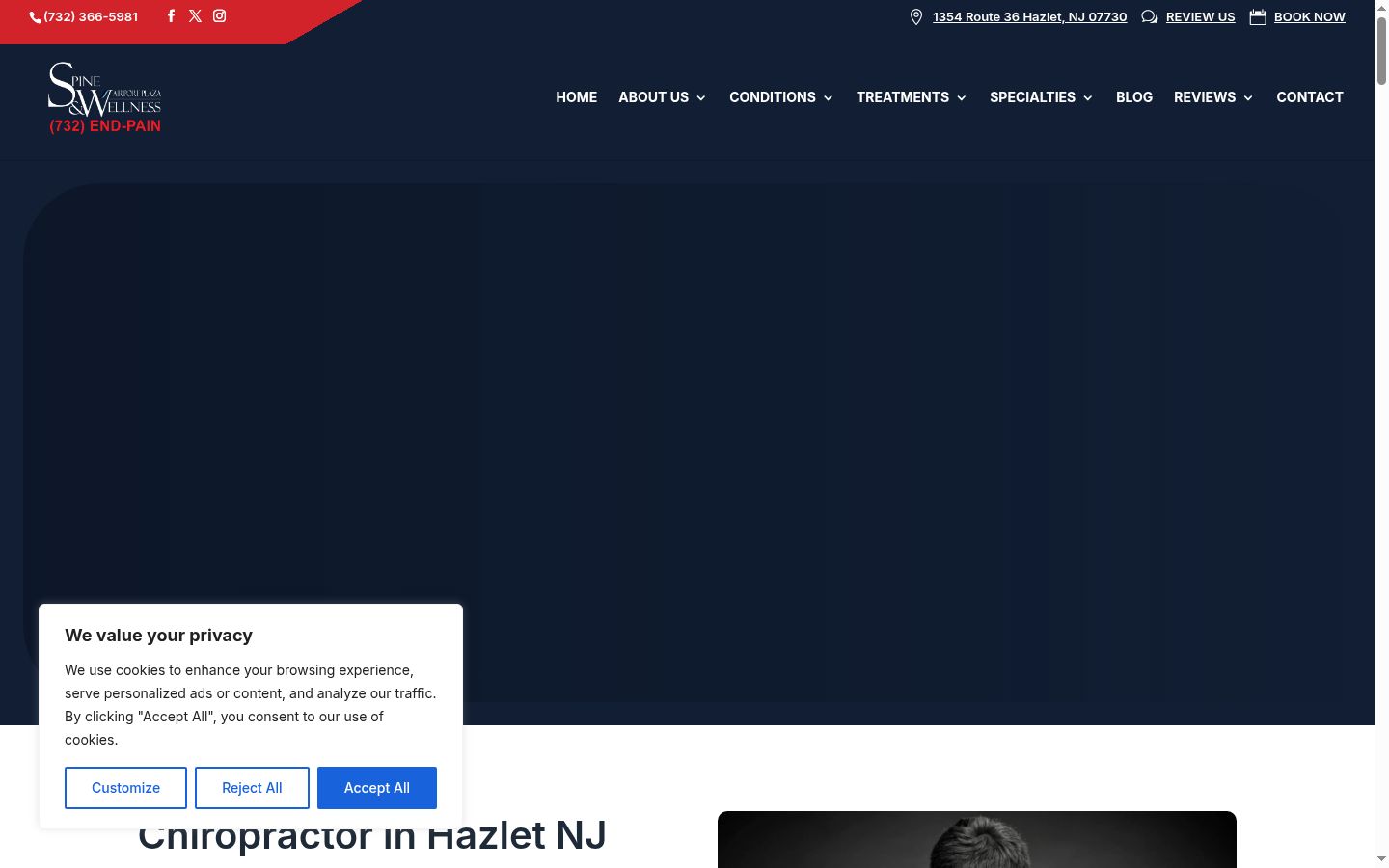Screenshot del banner di consenso mostrato prima di qualsiasi interazione