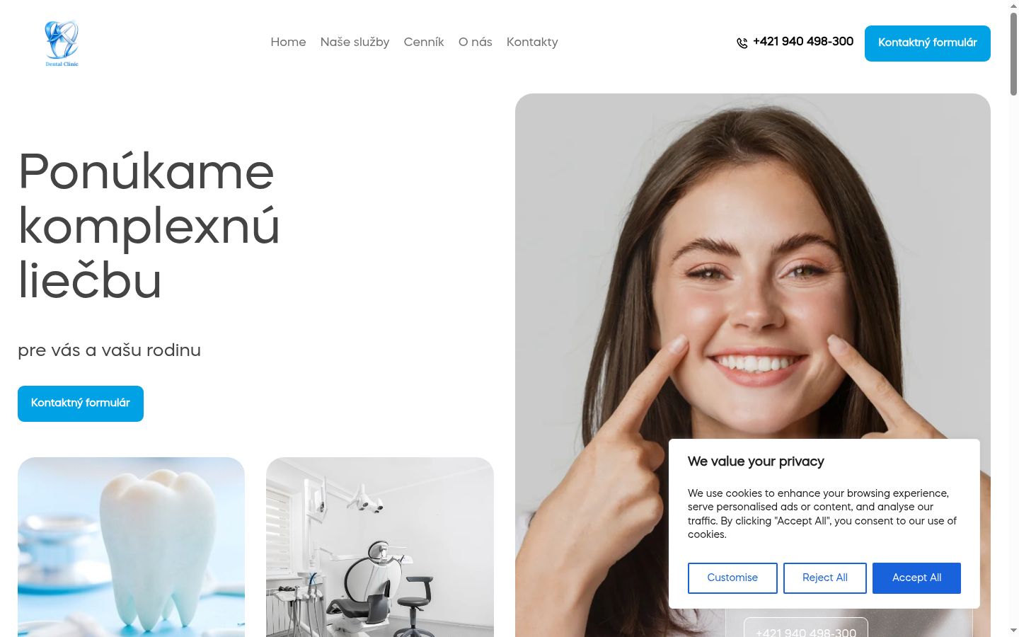 Screenshot del banner di consenso mostrato prima di qualsiasi interazione