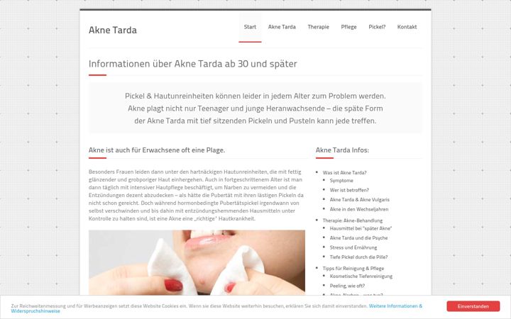 Screenshot of akne-tarda.de