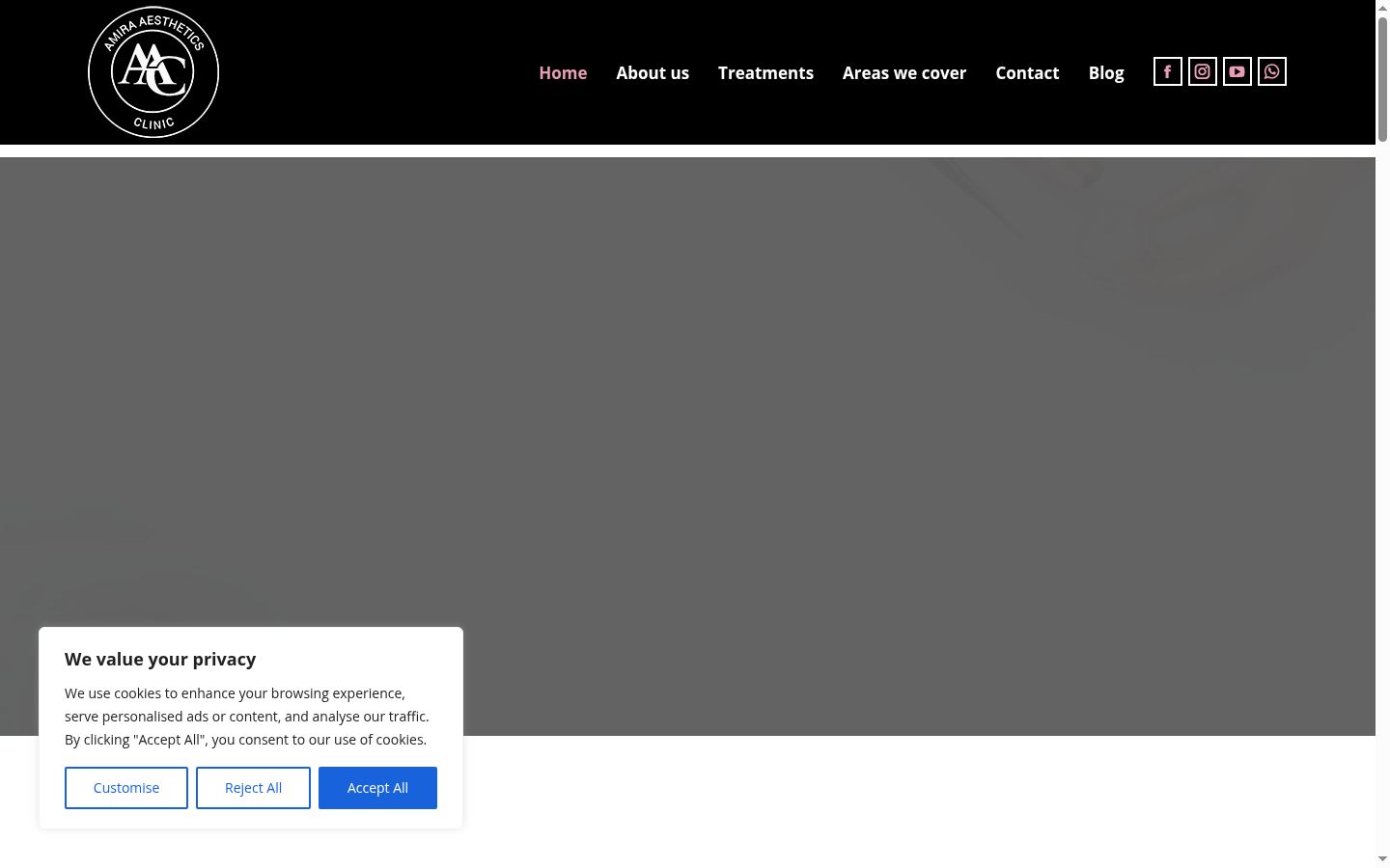 Screenshot of the consent banner shown before any interaction