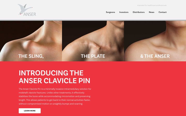 Screenshot ta' anserimplants.com