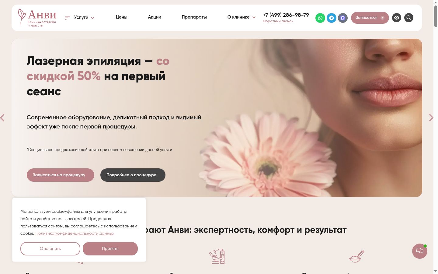 Screenshot of the consent banner shown before any interaction