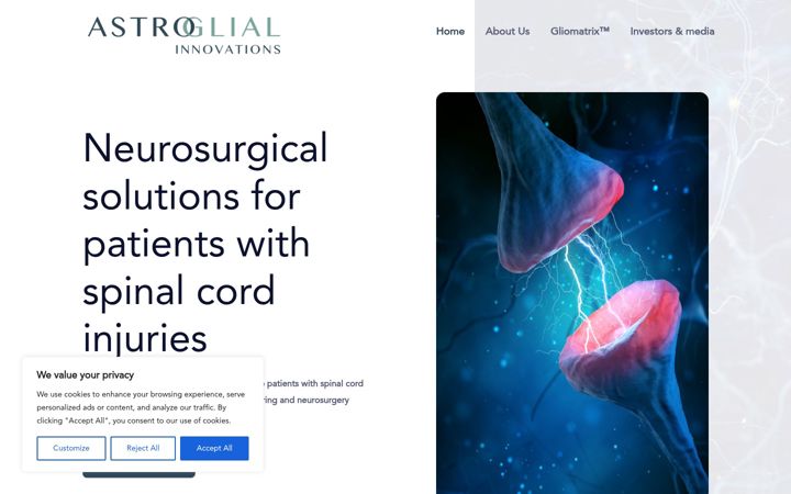 Screenshot of astroglial.com