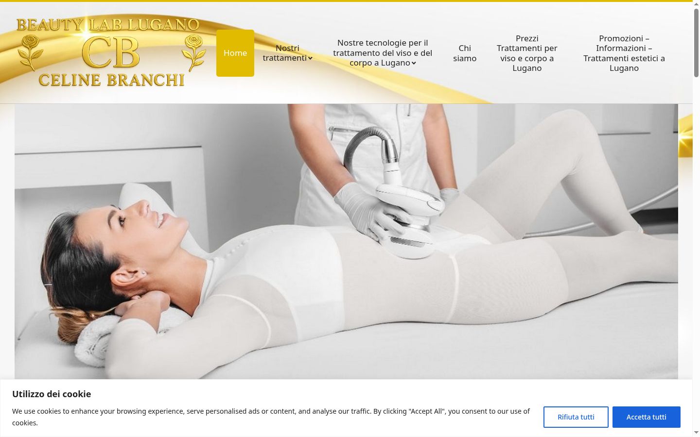 Screenshot des Einwilligungsbanners vor jeglicher Interaktion