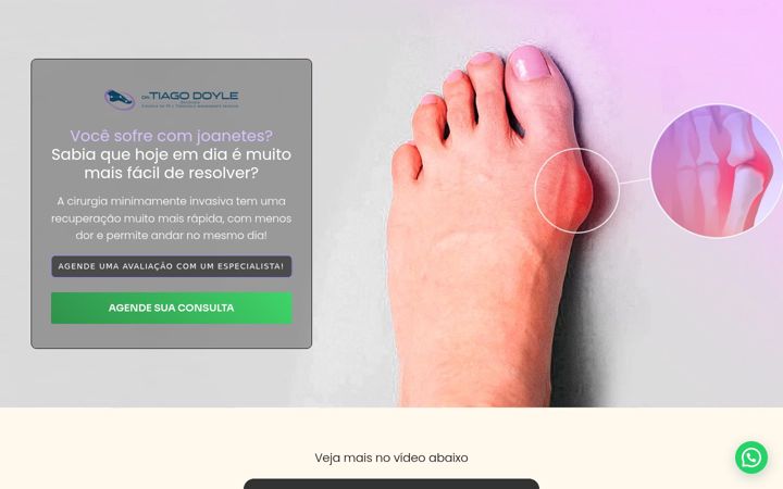 Screenshot van cirurgiadejoanete.com.br