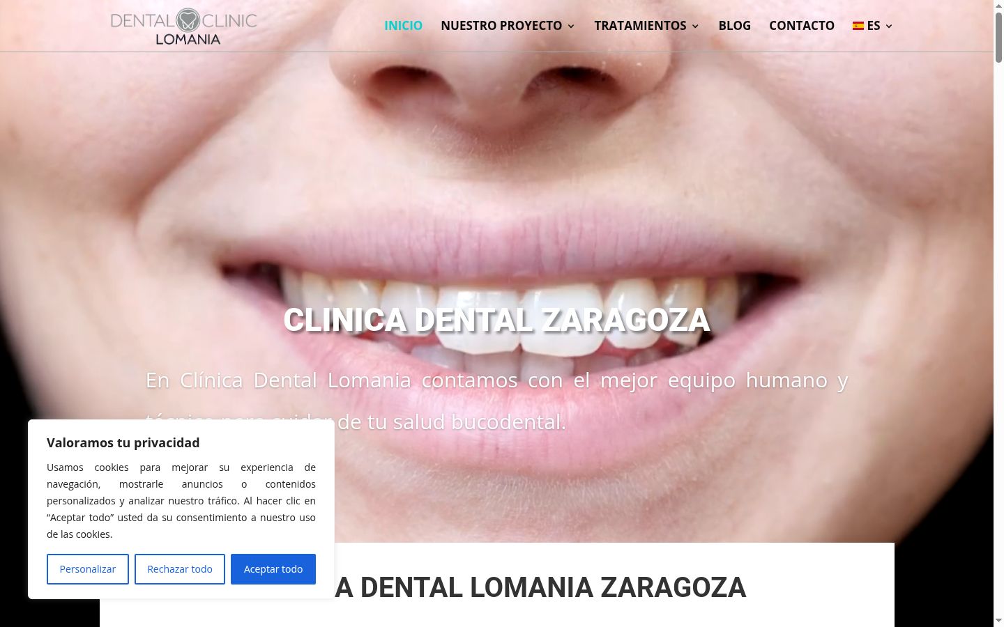 Captura de pantalla del banner de consentimiento mostrado antes de cualquier interacción