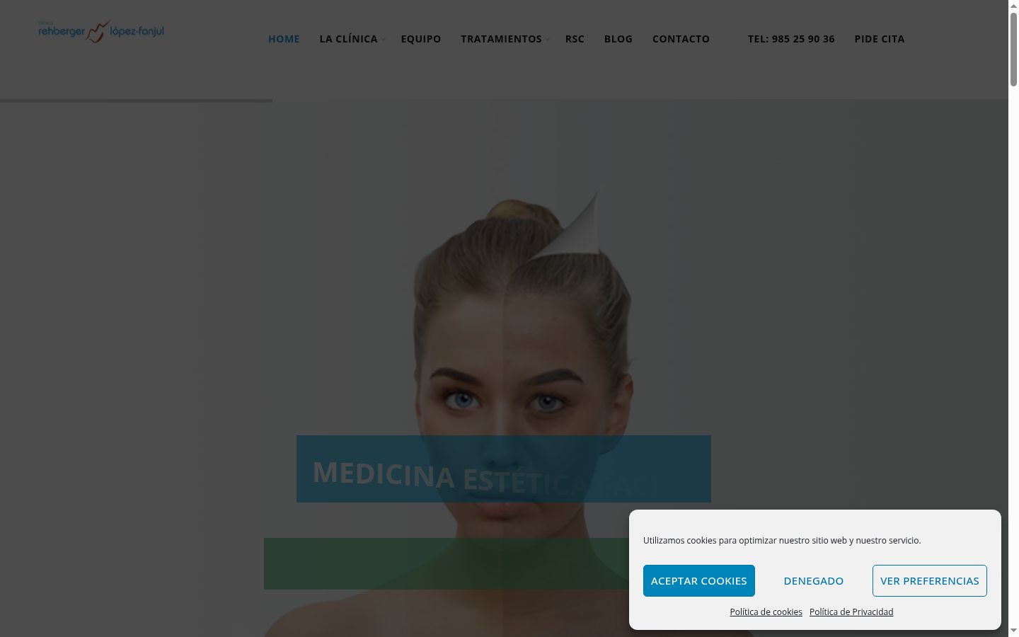 Captura de ecrã do banner de consentimento apresentado antes de qualquer interação