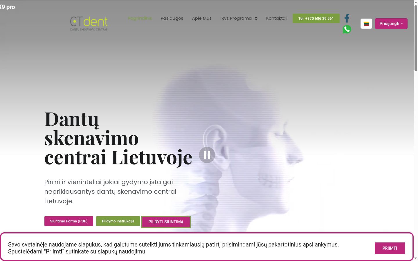 Screenshot del banner di consenso mostrato prima di qualsiasi interazione