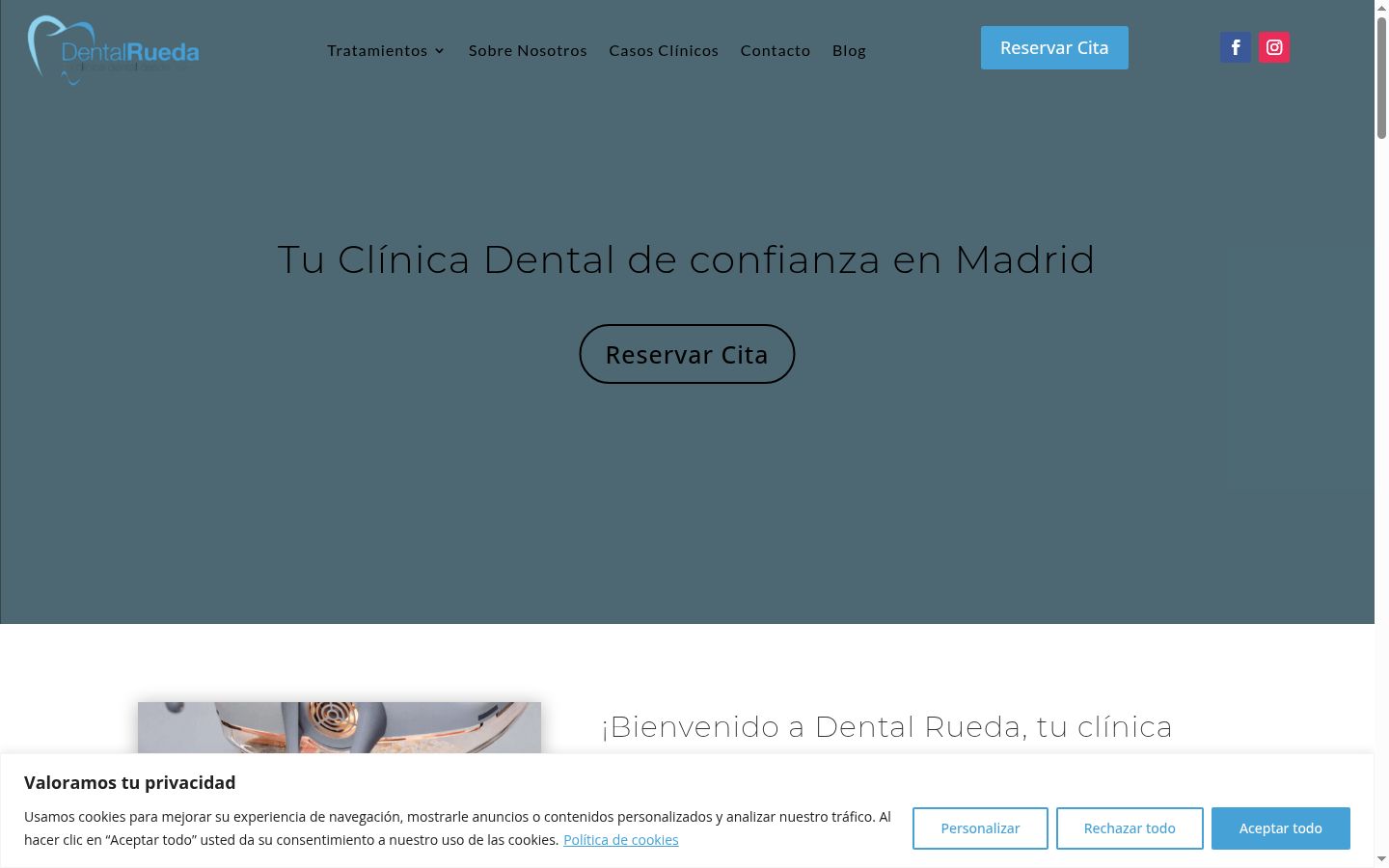 Screenshot del banner di consenso mostrato prima di qualsiasi interazione