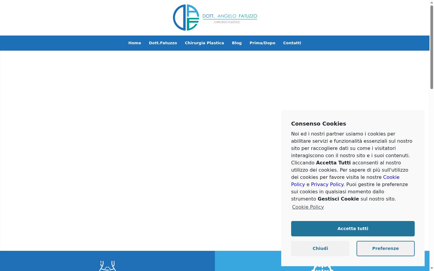 Screenshot del banner di consenso mostrato prima di qualsiasi interazione