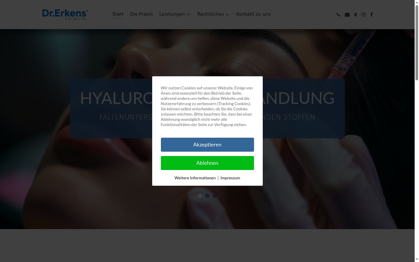 Screenshot of the consent banner shown before any interaction