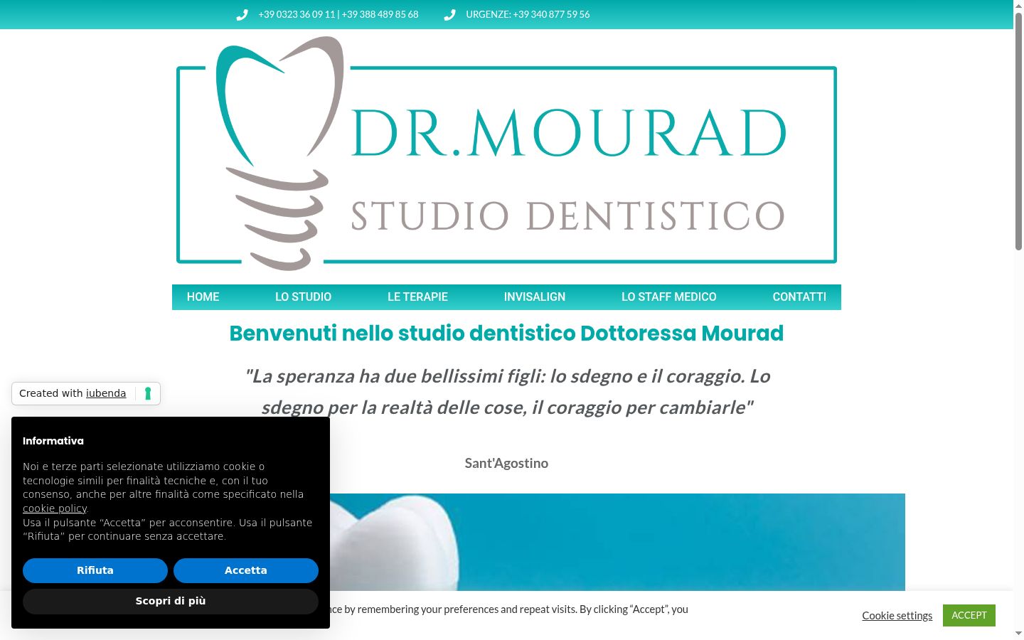Screenshot del banner di consenso mostrato prima di qualsiasi interazione