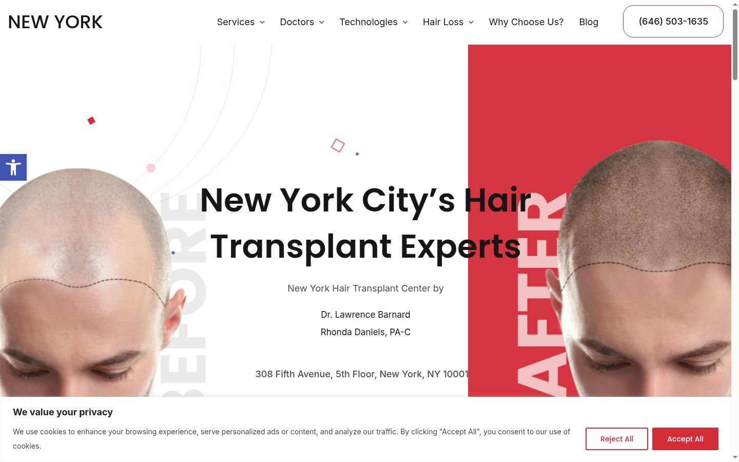 Screenshot of the consent banner shown before any interaction