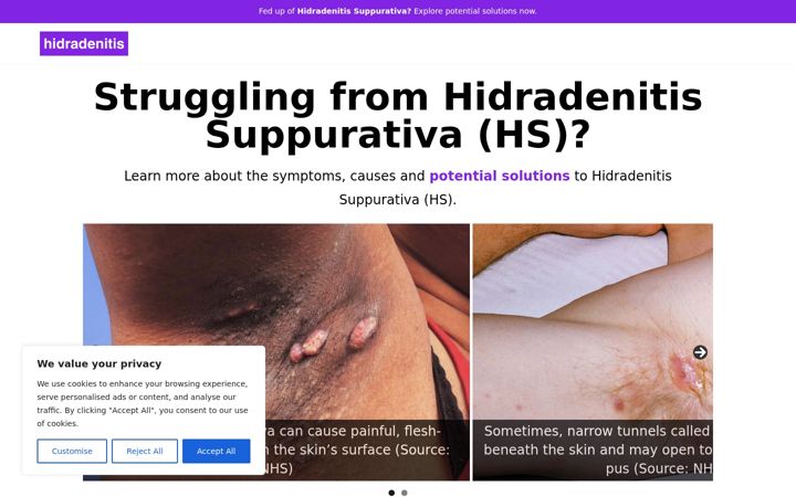 Screenshot of hidradenitis.co.uk