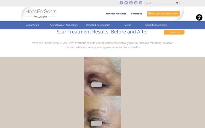 Screenshot of hopeforscars.com