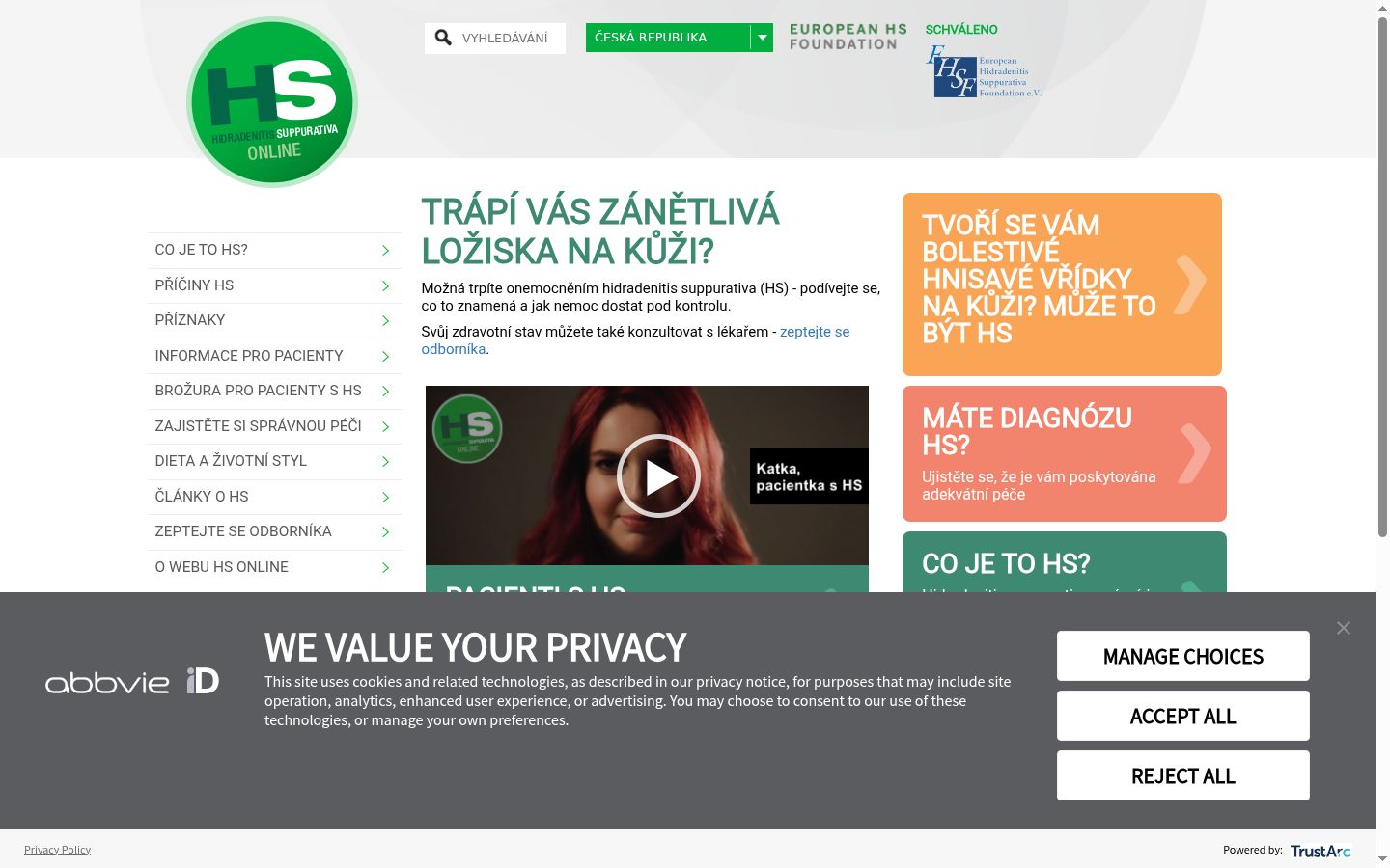 Screenshot of the consent banner shown before any interaction