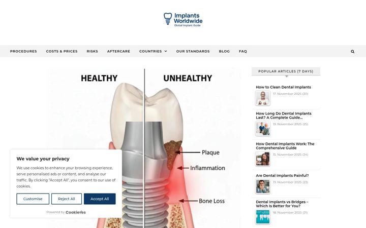 Screenshot of implantsworldwide.com