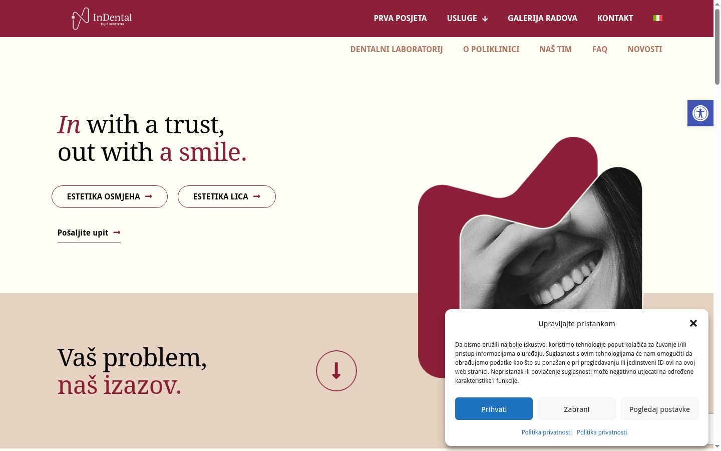 Screenshot del banner di consenso mostrato prima di qualsiasi interazione