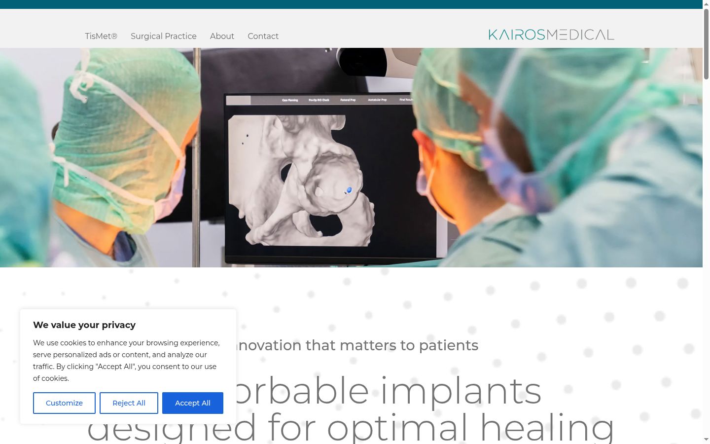 Screenshot of the consent banner shown before any interaction