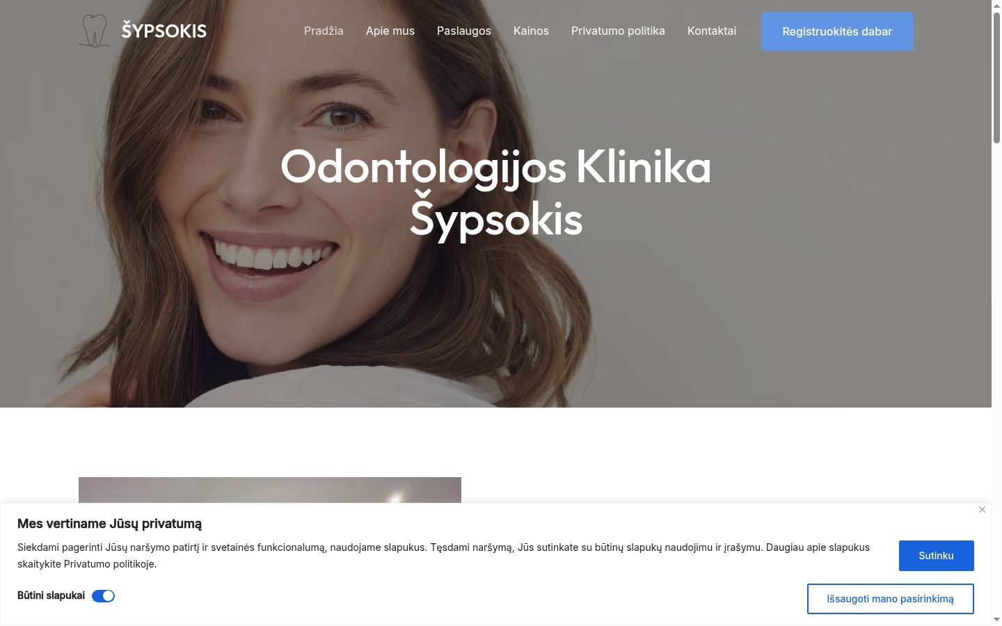Screenshot del banner di consenso mostrato prima di qualsiasi interazione
