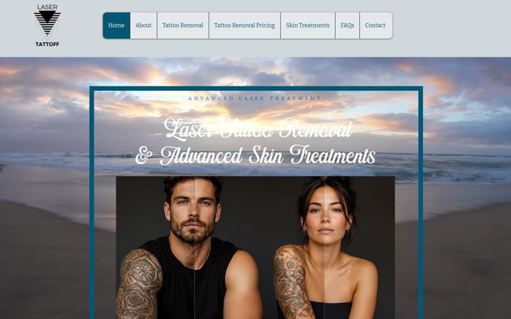 Screenshot of laser-tattoff.com