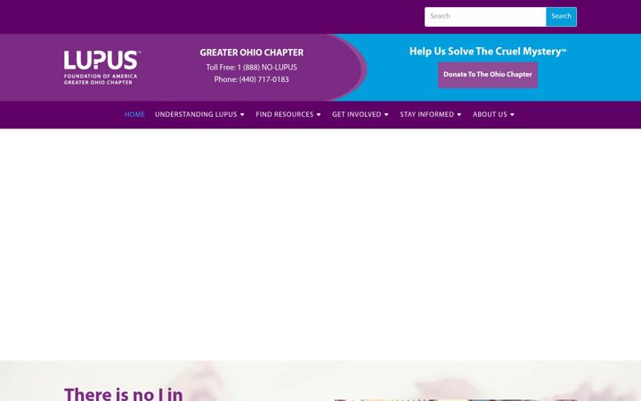 Screenshot of lupusgreaterohio.org