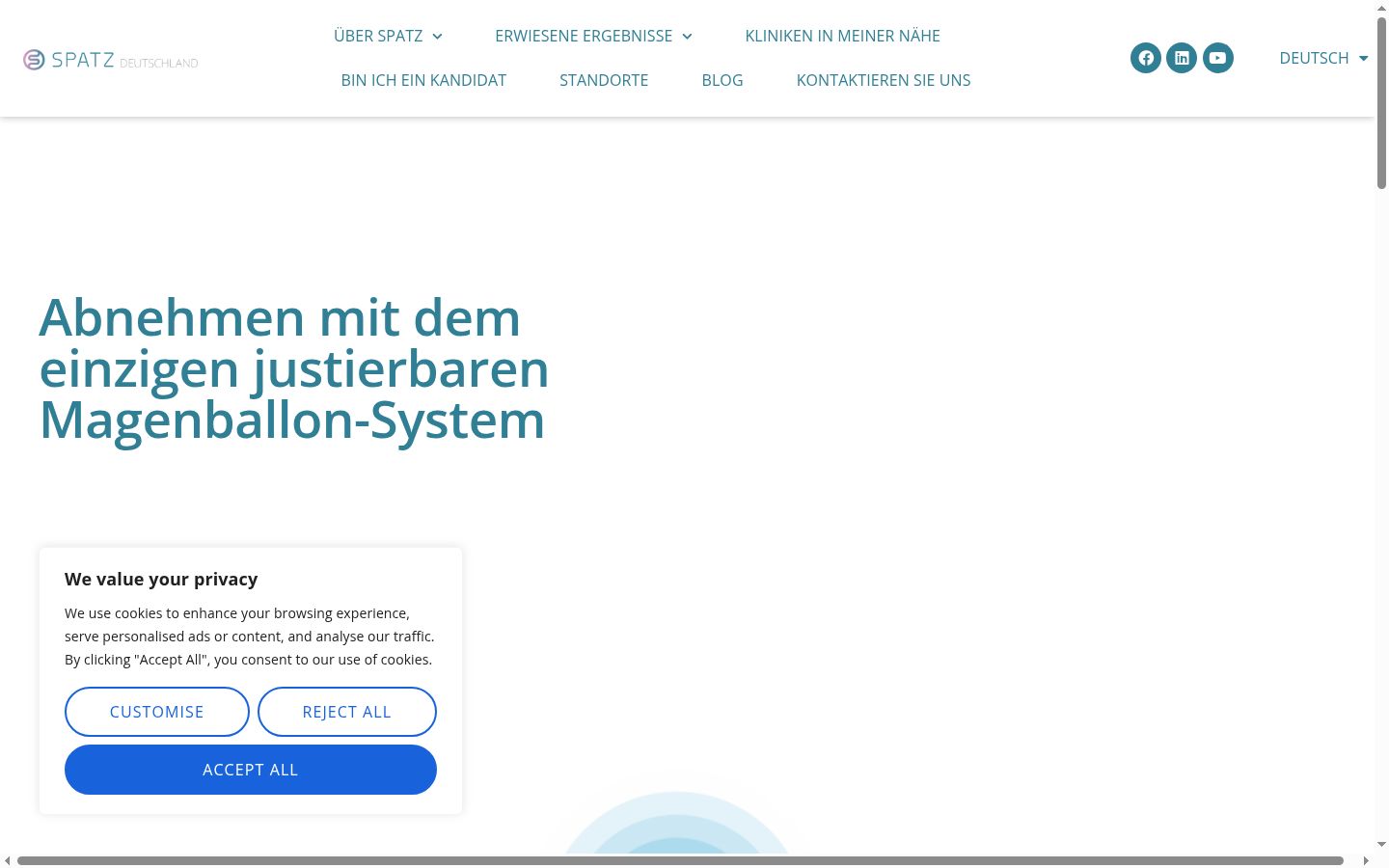 Screenshot des Einwilligungsbanners vor jeglicher Interaktion