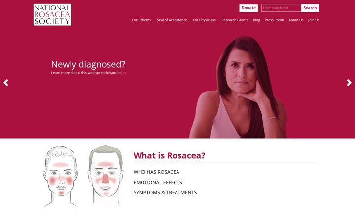 Zrzut ekranu rosacea.org