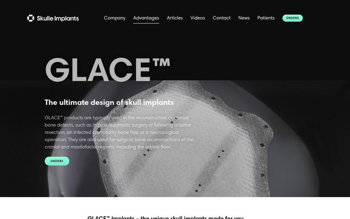 skulleimplants.com