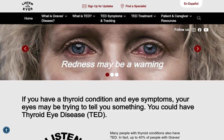 Screenshot di thyroideyes.com